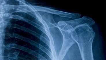 healthy shoulder joint