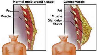 gyno