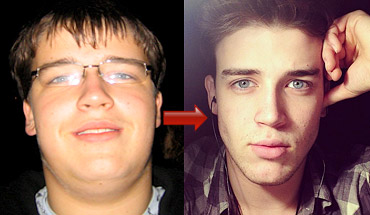 How to Get a Chiseled Jawline for Men & Teenagers  Lose Face Fat FAST (No  Fat Reduction Exercises) 
