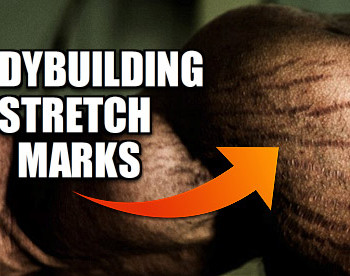 bodybuilding stretch marks