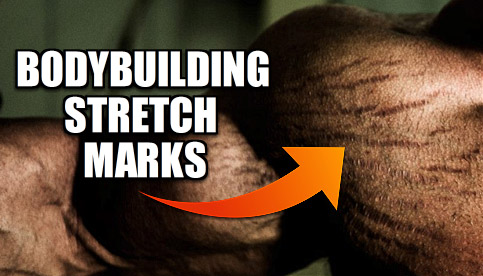 bodybuilding stretch marks