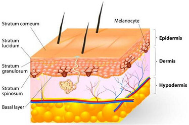 stretch marks