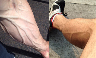 veiny arms and legs
